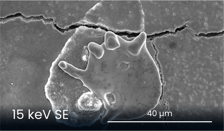 Higher accelerating voltages provide better resolution and electrons are less affected by aberrations. May be easier for new users, but surface detail may be obscured.